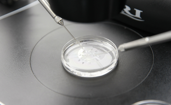 IVF med donerade spermier och donerade ägg (Dubbeldonation)