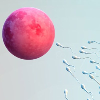 Intra-Uterine Insemination image