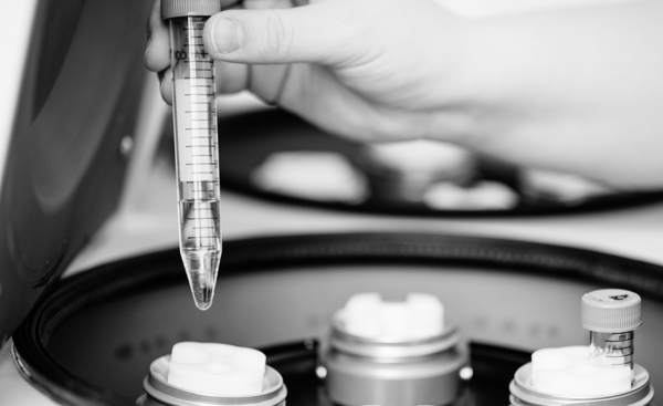 Possible Side Effects of Egg Freezing